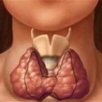 тиреоитид, щитовидная железа