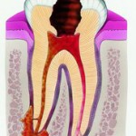 зубы, болевой синдром